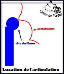 Luxation
